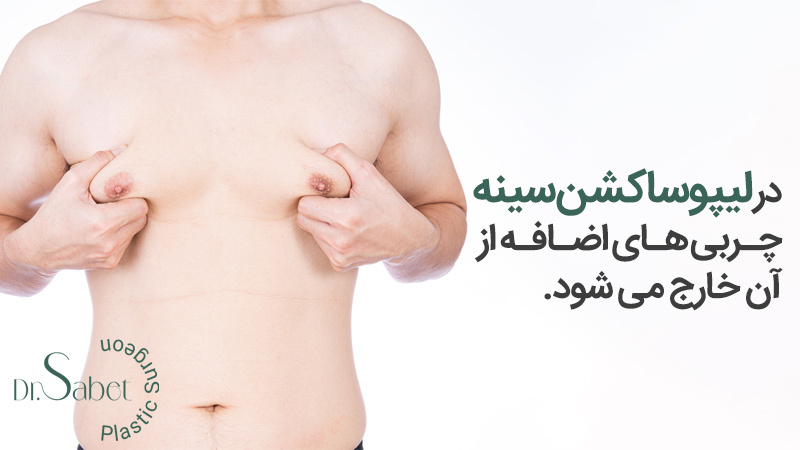 کوچک کردن سینه با روش لیپوماتیک | عمل كوچك كردن سينه با ليزر مردان